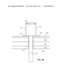 Endoscopic Ports and Related Kits and Methods diagram and image