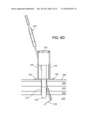 Endoscopic Ports and Related Kits and Methods diagram and image