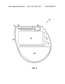 BATTERY AND CAPACITOR ARRANGEMENT FOR AN IMPLANTABLE MEDICAL DEVICE diagram and image