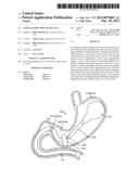 INTRAGASTRIC IMPLANT DEVICES diagram and image