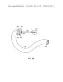 INTRAGASTRIC IMPLANT DEVICES diagram and image