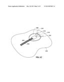 FIBEROPTIC PROBE FOR MEASURING TISSUE OXYGENATION AND METHOD FOR USING     SAME diagram and image