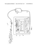 TECHNIQUE FOR REMANUFACTURING A BIS SENSOR diagram and image