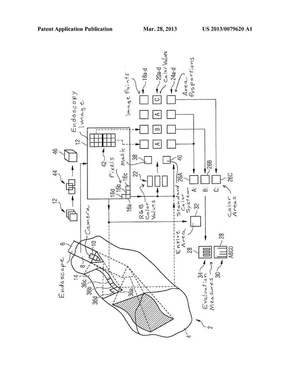 METHOD FOR PROCESSING AN ENDOSCOPY IMAGE - diagram, schematic, and image 02