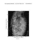 SYSTEMS AND METHODS FOR AUTOMATED DYNAMIC CONTRAST ENHANCEMENT IMAGING diagram and image