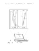 Spinal Distraction Tool For Load And Position Measurement diagram and image