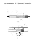 Flow Directional Infusion Device diagram and image