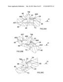 Surface Treatment Device and Method diagram and image