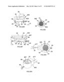 Surface Treatment Device and Method diagram and image