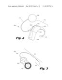 Modular Drug Delivery System for Minimizing Trauma During and After     Insertion of a Cochlear Lead diagram and image