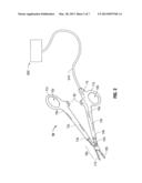 Surgical Tissue Occluding Device diagram and image