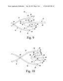 PATELLA DRILLING SYSTEM diagram and image