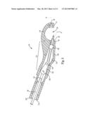 SUTURING DEVICE WITH SUTURING CAPSULE REMOVAL MECHANISM diagram and image