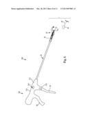 SUTURING DEVICE WITH SUTURING CAPSULE REMOVAL MECHANISM diagram and image