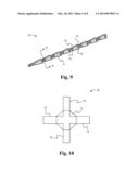 Interlocking Sutures diagram and image