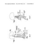 BAROREFLEX MODULATION TO GRADUALLY CHANGE A PHYSIOLOGICAL PARAMETER diagram and image