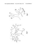 BAROREFLEX MODULATION TO GRADUALLY CHANGE A PHYSIOLOGICAL PARAMETER diagram and image