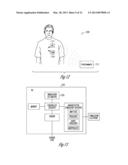 BAROREFLEX MODULATION TO GRADUALLY CHANGE A PHYSIOLOGICAL PARAMETER diagram and image