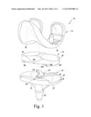 FIXED-BEARING KNEE PROSTHESIS HAVING A LOCKING MECHANISM WITH A     CONCAVE-TO-CONVEX MATING INTERFACE diagram and image