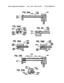 Systems and Methods for Applying Texture Material to Ceiling Surfaces diagram and image