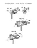 Systems and Methods for Applying Texture Material to Ceiling Surfaces diagram and image