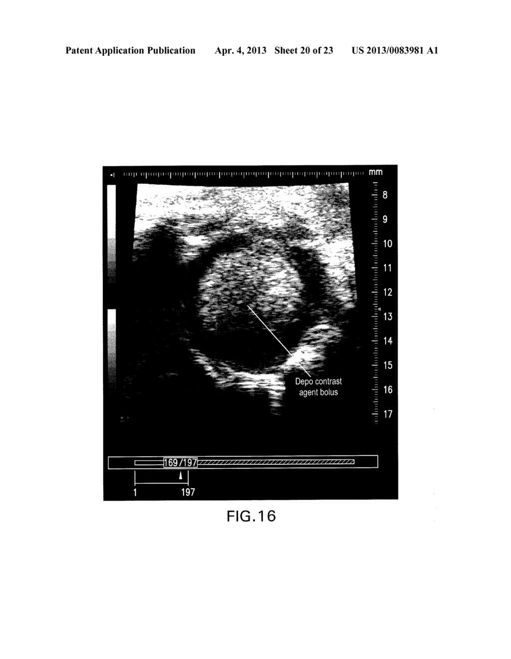 OVERLAY IMAGE CONTRAST ENHANCEMENT - diagram, schematic, and image 21