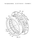 Bearing Housing for an Engine with Stress and Stiffness Control diagram and image