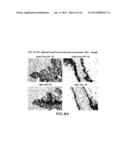 IGF-1R SPECIFIC ANTIBODIES USEFUL IN THE DETECTION AND DIAGNOSIS OF     CELLULAR PROLIFERATIVE DISORDERS diagram and image