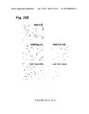 METHYLATED CODING AND NON-CODING RNA GENES AS DIAGNOSTIC AND THERAPEUTIC     TOOLS FOR HUMAN MELANOMA diagram and image