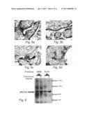 VARIANTS OF VEGFR AND THEIR USE IN THE DIAGNOSIS AND TREATMENT OF     PREGNANCY ASSOCIATED MEDICAL CONDITIONS diagram and image