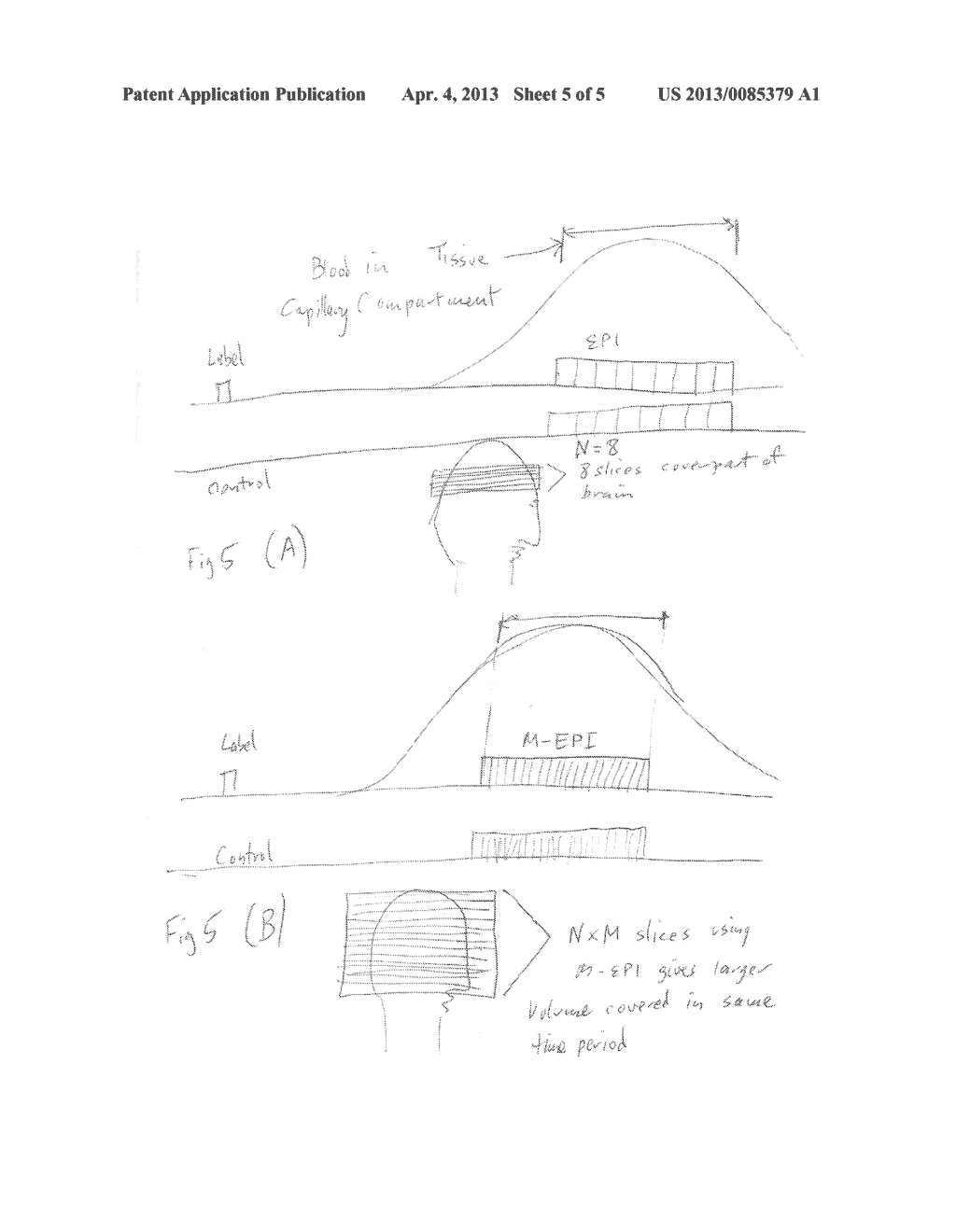 ARTERIAL SPIN-LABELED (ASL) MULTIPLEXED ECHO PLANAR IMAGING (M-EPI) - diagram, schematic, and image 06