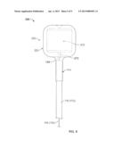 Electrosurgical Balloons diagram and image