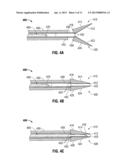 Surgical Forceps diagram and image