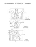 Support device and method diagram and image