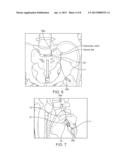 Support device and method diagram and image