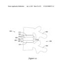 INTERBODY VERTEBRAL SPACER diagram and image