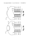 Article of Apparel Providing Enhanced Body Position Feedback diagram and image