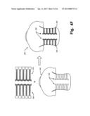 Article of Apparel Providing Enhanced Body Position Feedback diagram and image