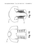 Article of Apparel Providing Enhanced Body Position Feedback diagram and image