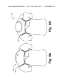 Article of Apparel Providing Enhanced Body Position Feedback diagram and image