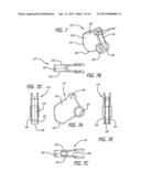 Utility Knife diagram and image