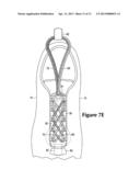 Footwear Lacing System diagram and image