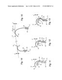 CUSHION FOR PATIENT INTERFACE diagram and image