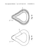 CUSHION FOR PATIENT INTERFACE diagram and image