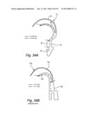 CUSHION FOR PATIENT INTERFACE diagram and image