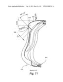 CUSHION FOR PATIENT INTERFACE diagram and image