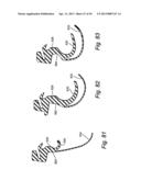 CUSHION FOR PATIENT INTERFACE diagram and image