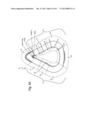 CUSHION FOR PATIENT INTERFACE diagram and image