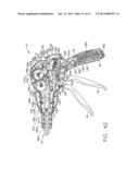 SURGICAL INSTRUMENT diagram and image