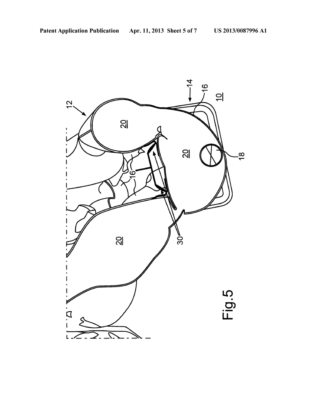 Restraint Device, in Particular for a Motor Vehicle - diagram, schematic, and image 06